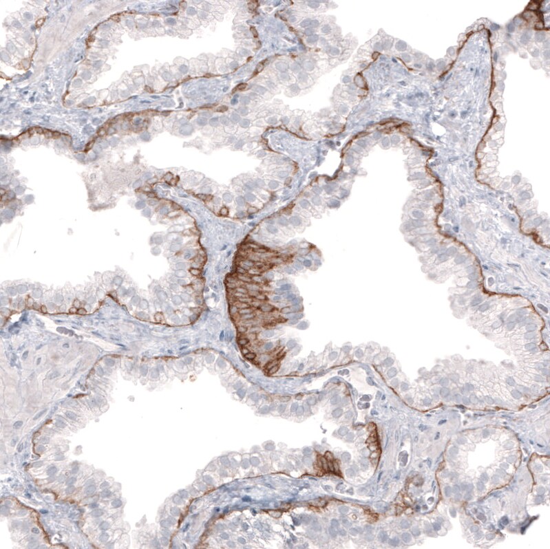 Laminin beta 3 Antibody (CL3353) Immunohistochemistry: Laminin beta 3 Antibody (CL3353) [NBP3-52063]