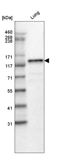 Laminin beta 3 Antibody (CL3353) Western Blot: Laminin beta 3 Antibody (CL3353) [NBP3-52063]