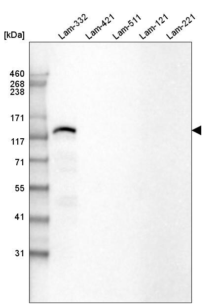 Laminin beta 3 Antibody (CL3353) Western Blot: Laminin beta 3 Antibody (CL3353) [NBP3-52063]