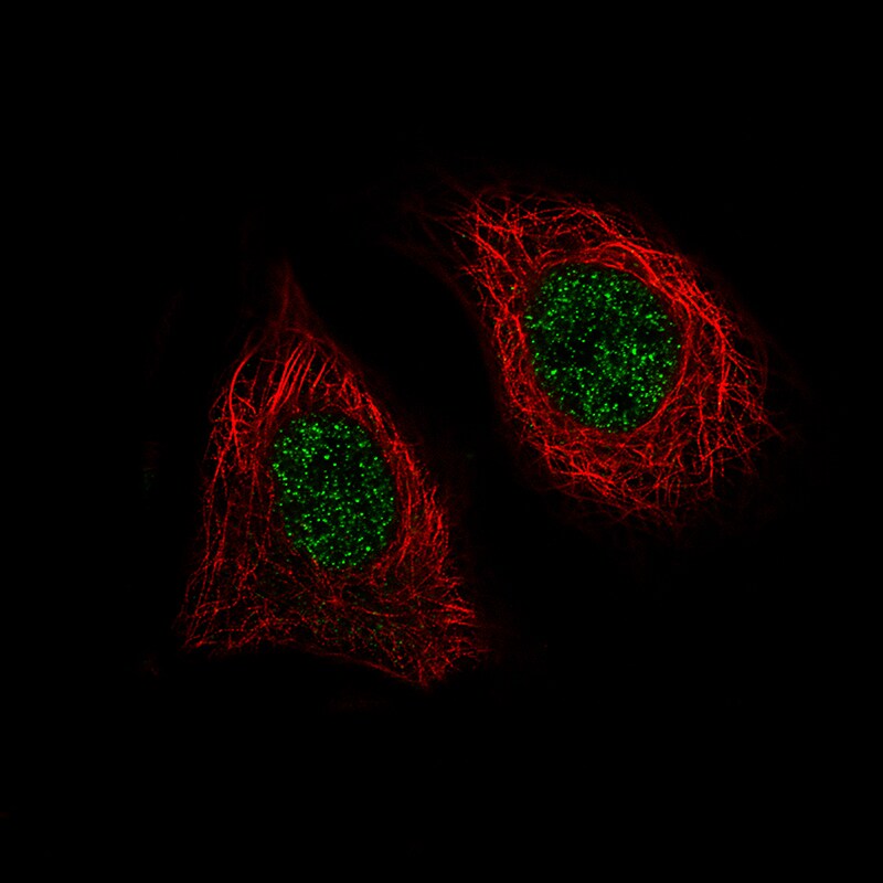 BRD4 Antibody (CL1115) Immunocytochemistry/ Immunofluorescence: BRD4 Antibody (CL1115) [NBP3-52453]