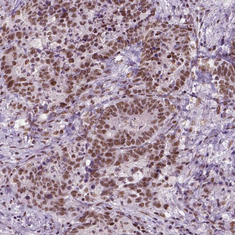 BRD4 Antibody (CL1115) Immunohistochemistry: BRD4 Antibody (CL1115) [NBP3-52453]