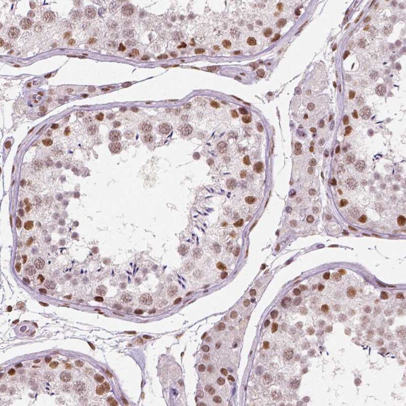 BRD4 Antibody (CL1115) Immunohistochemistry: BRD4 Antibody (CL1115) [NBP3-52453]