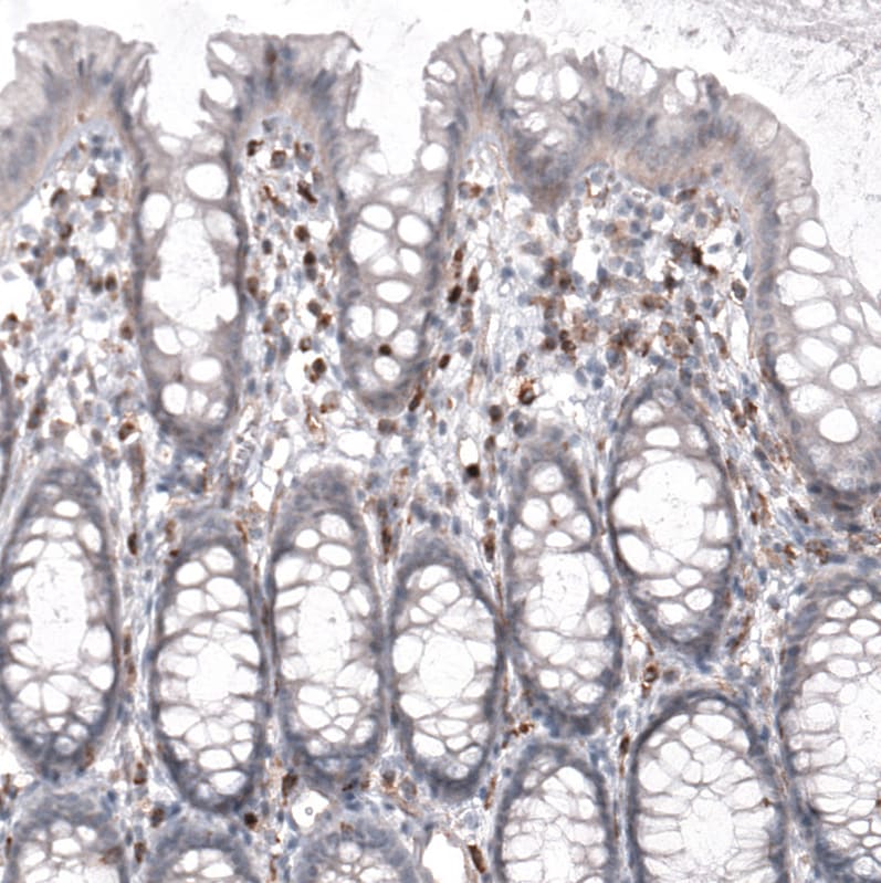 VISTA/B7-H5/PD-1H Antibody (CL3975) Immunohistochemistry: VISTA/B7-H5/PD-1H Antibody (CL3975) [NBP3-52473]