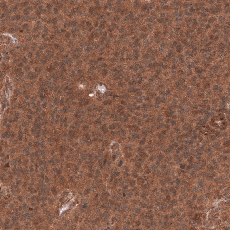 YAP1 Antibody (CL13628) Immunohistochemistry: YAP1 Antibody (CL13628) [NBP3-52066]