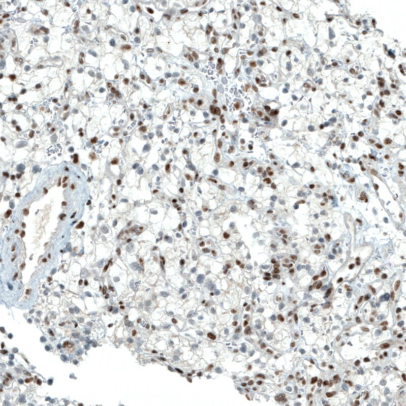 BAF180/PB1 Antibody (CL0331) Immunohistochemistry: BAF180/PB1 Antibody (CL0331) [NBP3-52067]