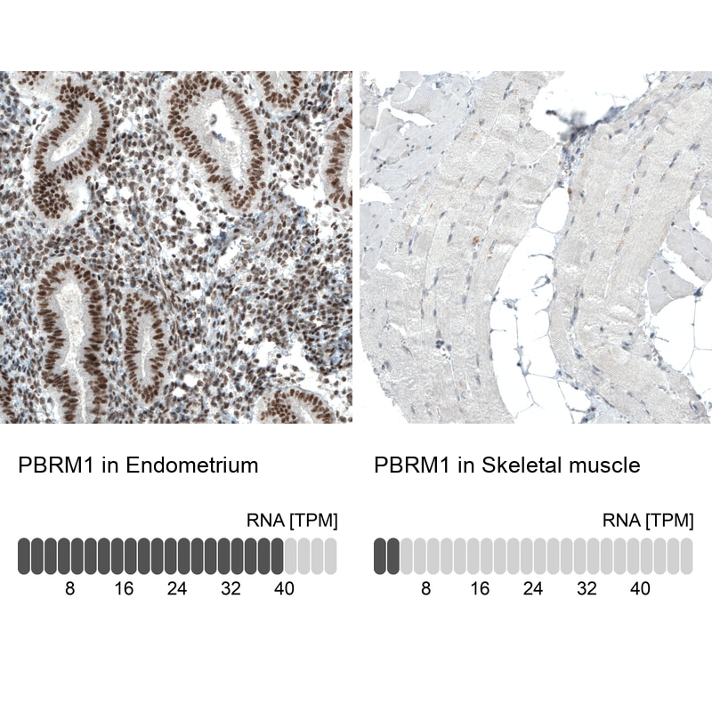 BAF180/PB1 Antibody (CL0331) Immunohistochemistry: BAF180/PB1 Antibody (CL0331) [NBP3-52067]