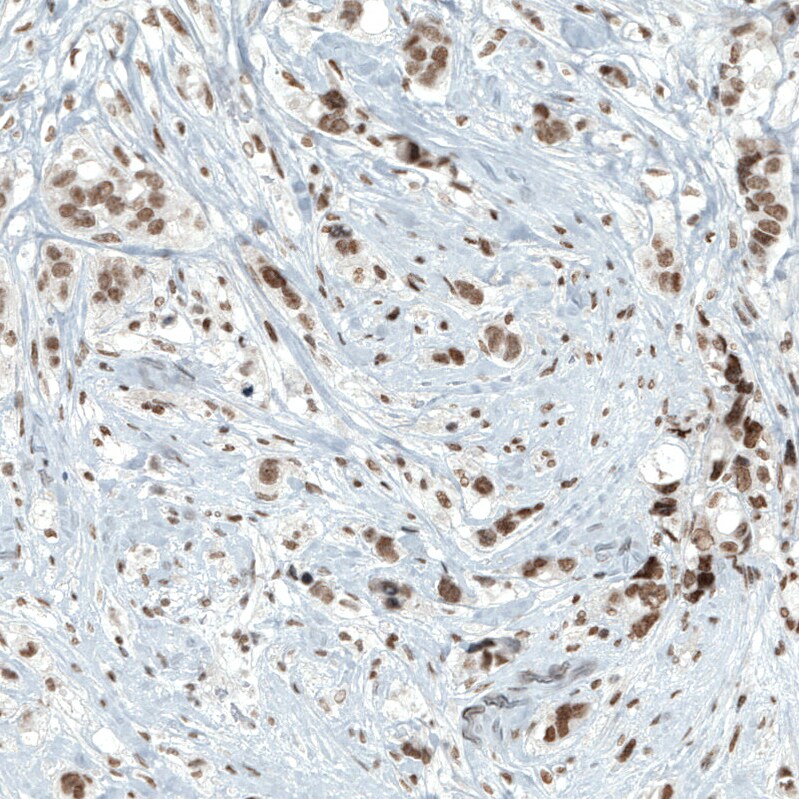 BAF180/PB1 Antibody (CL0331) Immunohistochemistry: BAF180/PB1 Antibody (CL0331) [NBP3-52067]