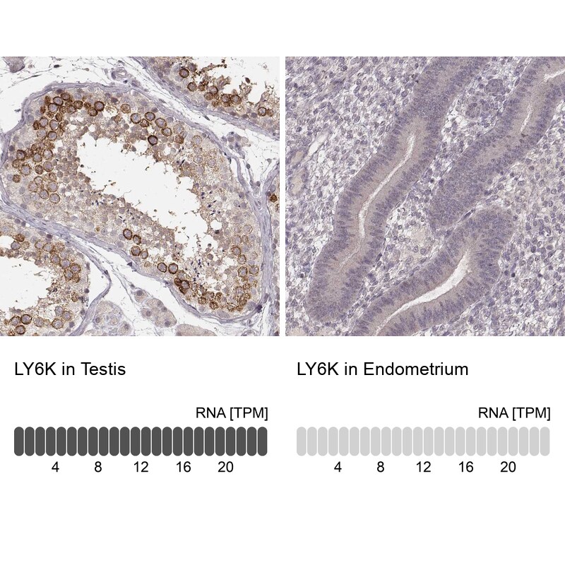 Ly6K Antibody (CL2435) Immunohistochemistry: Ly6K Antibody (CL2435) [NBP3-52068]