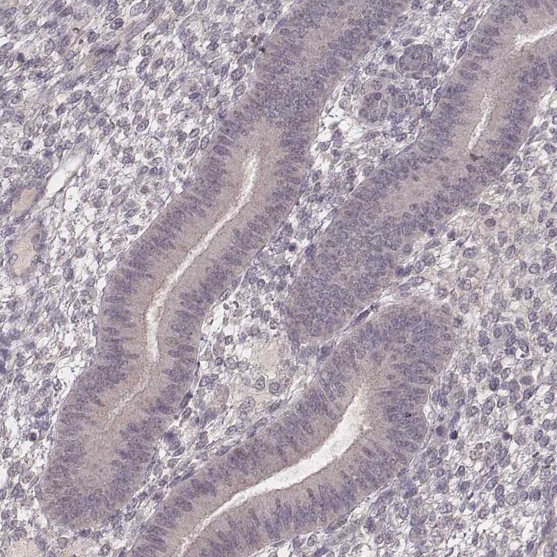Ly6K Antibody (CL2435) Immunohistochemistry: Ly6K Antibody (CL2435) [NBP3-52068]