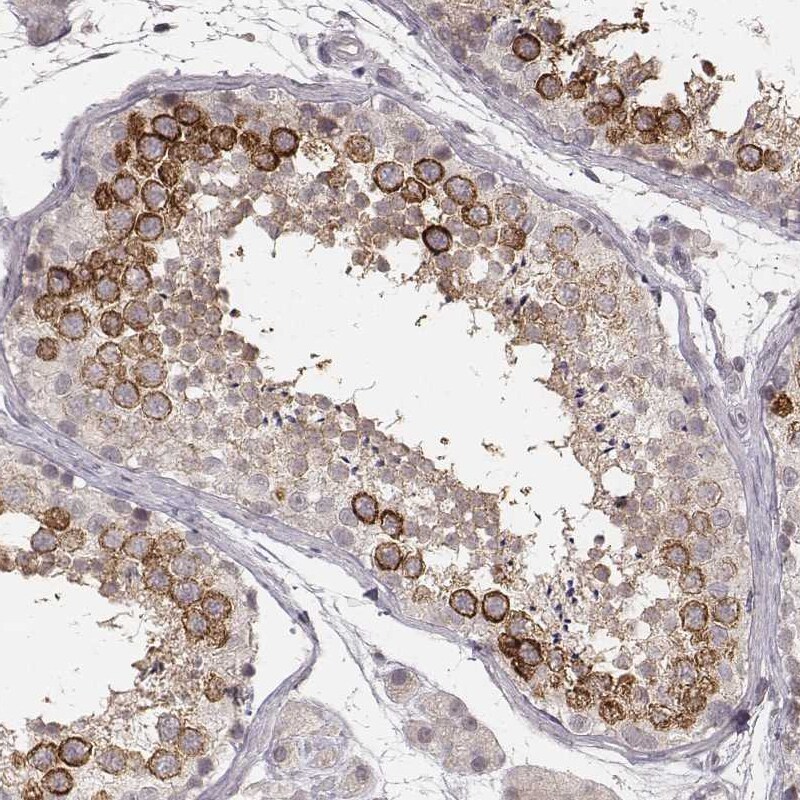Ly6K Antibody (CL2435) Immunohistochemistry: Ly6K Antibody (CL2435) [NBP3-52068]