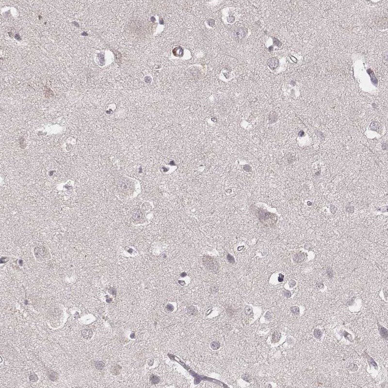 Ly6K Antibody (CL2435) Immunohistochemistry: Ly6K Antibody (CL2435) [NBP3-52068]