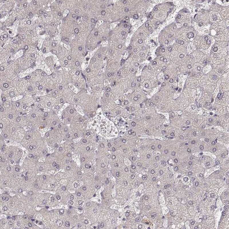 Ly6K Antibody (CL2435) Immunohistochemistry: Ly6K Antibody (CL2435) [NBP3-52068]