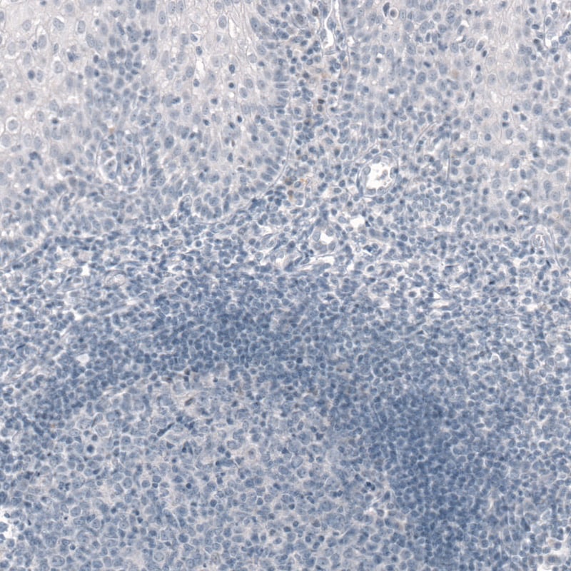 T-box 19 Antibody (CL6251) Immunohistochemistry: T-box 19 Antibody (CL6251) [NBP3-52069]