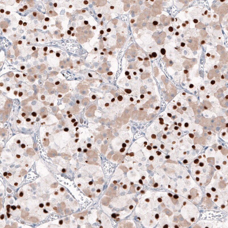 T-box 19 Antibody (CL6251) Immunohistochemistry: T-box 19 Antibody (CL6251) [NBP3-52069]