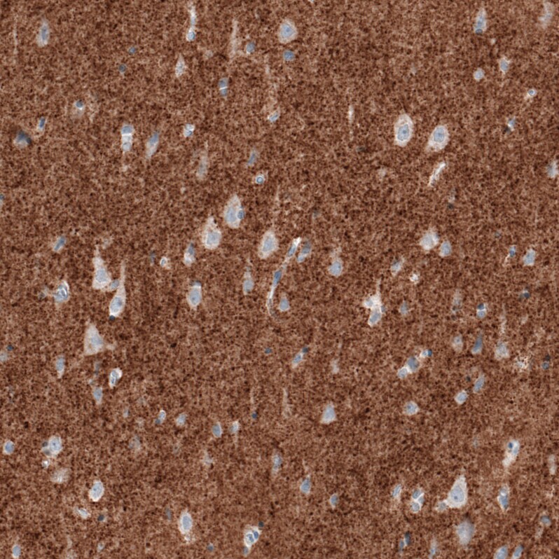 VGLUT2 Antibody (CL2921) Immunohistochemistry: VGLUT2 Antibody (CL2921) [NBP3-52463]