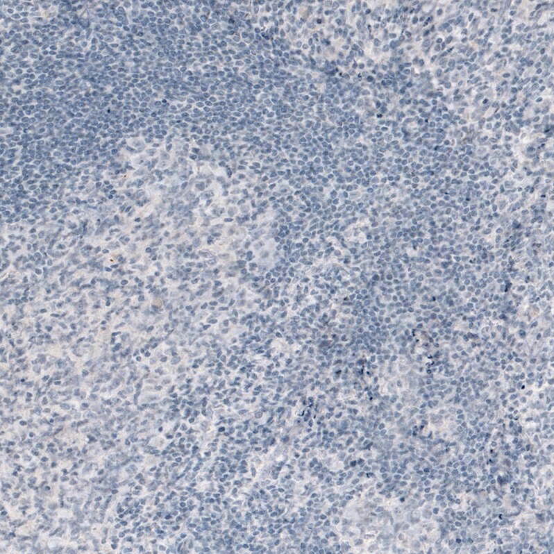VGLUT2 Antibody (CL2921) Immunohistochemistry: VGLUT2 Antibody (CL2921) [NBP3-52463]