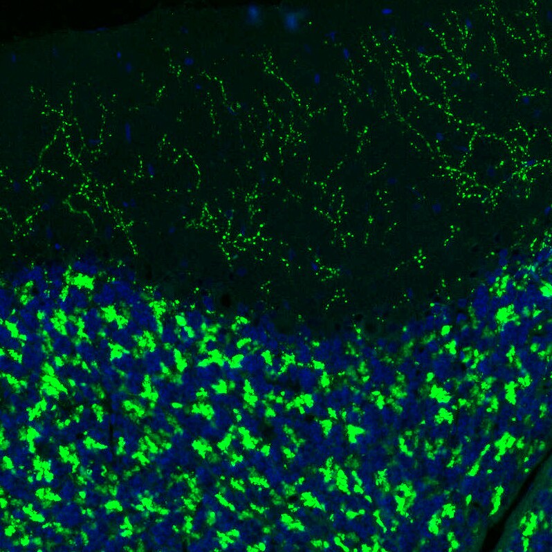 VGLUT2 Antibody (CL2921) Immunohistochemistry: VGLUT2 Antibody (CL2921) [NBP3-52463]