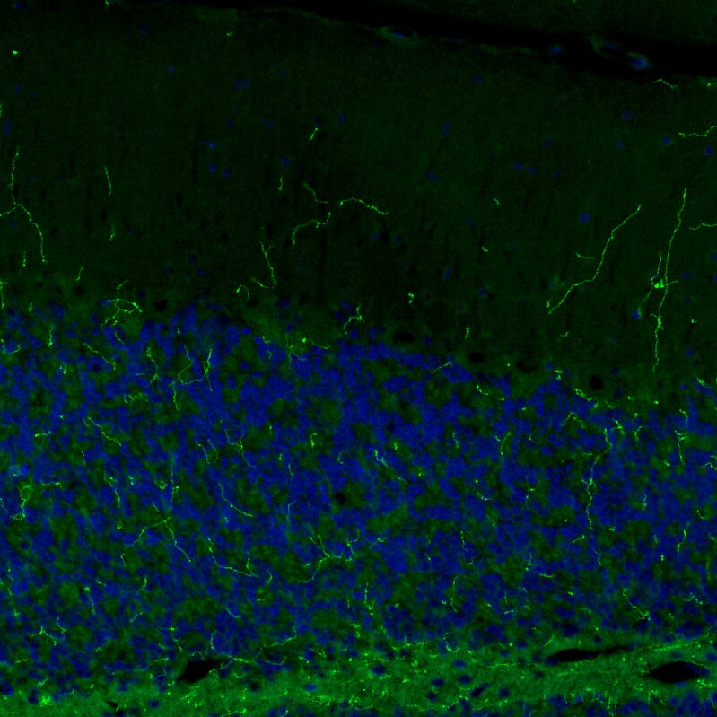 SLC6A2/NET/Noradrenaline transporter Antibody (CL3063) Immunohistochemistry: SLC6A2/NET/Noradrenaline transporter Antibody (CL3063) [NBP3-52466]