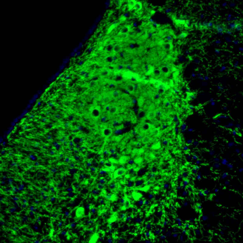 SLC6A2/NET/Noradrenaline transporter Antibody (CL3063) Immunohistochemistry: SLC6A2/NET/Noradrenaline transporter Antibody (CL3063) [NBP3-52466]