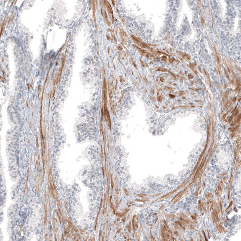 PCP4 Antibody (CL5306) Immunohistochemistry: PCP4 Antibody (CL5306) [NBP3-52479]