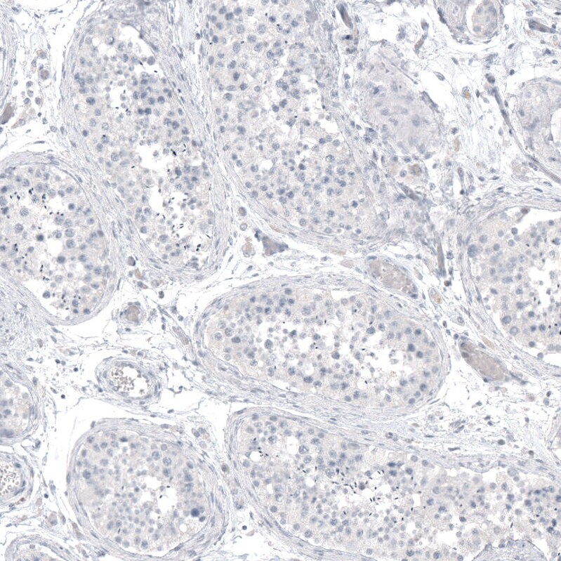 PCP4 Antibody (CL5306) Immunohistochemistry: PCP4 Antibody (CL5306) [NBP3-52479]