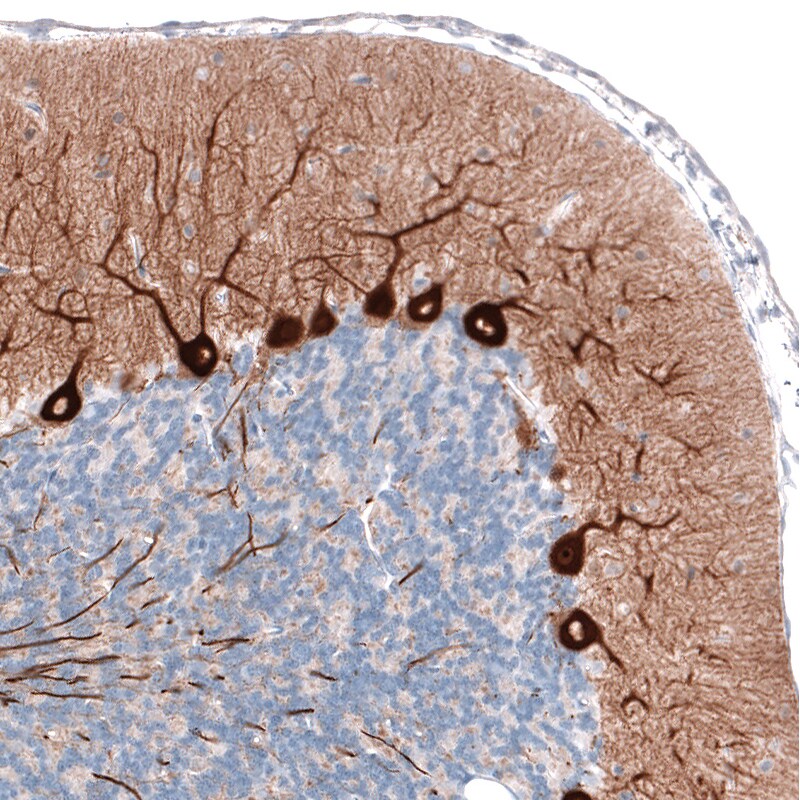 PCP4 Antibody (CL5306) Immunohistochemistry: PCP4 Antibody (CL5306) [NBP3-52479]