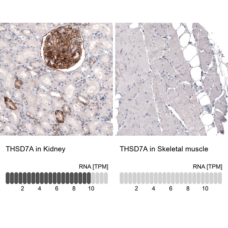 THSD7A Antibody (CL3778) Immunohistochemistry: THSD7A Antibody (CL3778) [NBP3-52472]