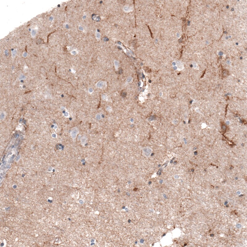 THSD7A Antibody (CL3778) Immunohistochemistry: THSD7A Antibody (CL3778) [NBP3-52472]
