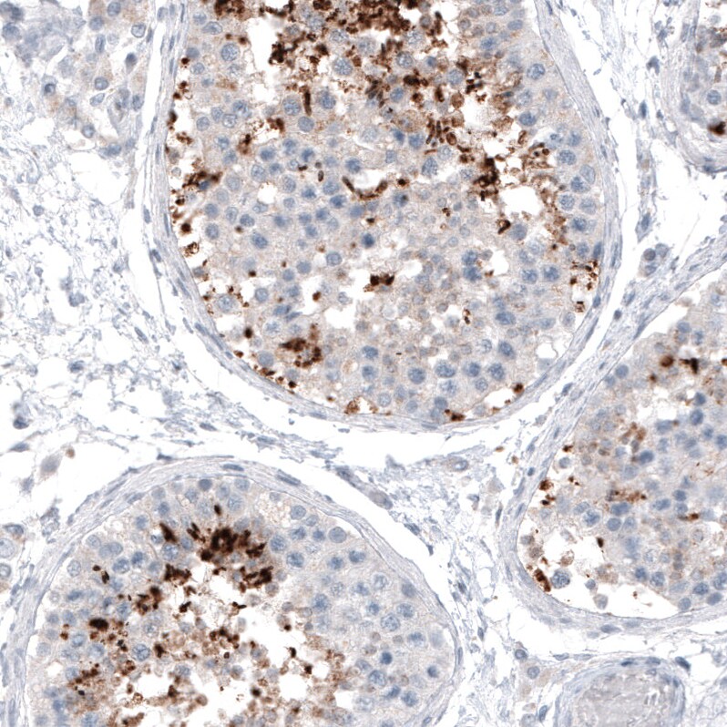 CT83 Antibody (CL4762) Immunohistochemistry: CT83 Antibody (CL4762) [NBP3-52476]