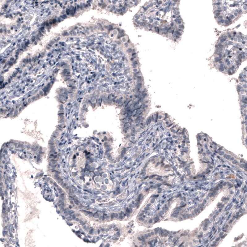 Dopa Decarboxylase/DDC Antibody (CL2962) Immunohistochemistry: Dopa Decarboxylase/DDC Antibody (CL2962) [NBP3-52464]
