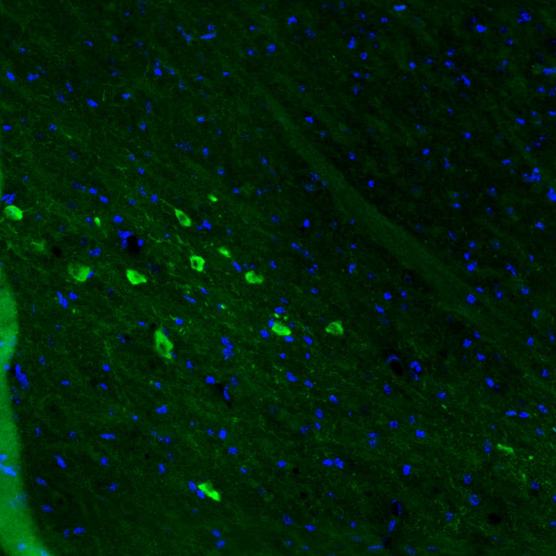 Dopa Decarboxylase/DDC Antibody (CL2962) Immunohistochemistry: Dopa Decarboxylase/DDC Antibody (CL2962) [NBP3-52464]