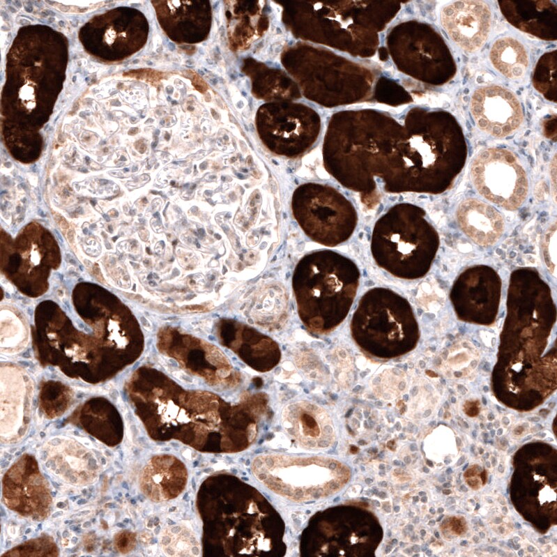 Dopa Decarboxylase/DDC Antibody (CL2962) Immunohistochemistry: Dopa Decarboxylase/DDC Antibody (CL2962) [NBP3-52076]