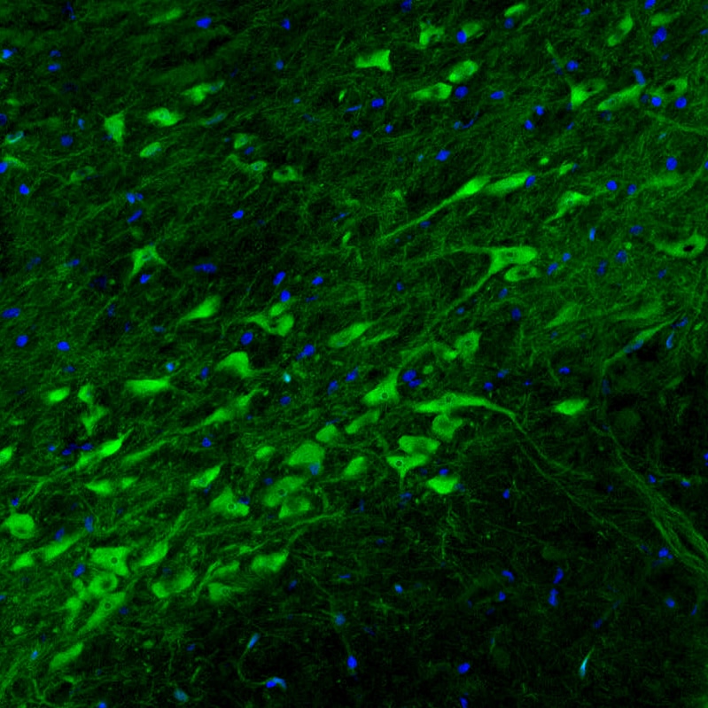 Dopa Decarboxylase/DDC Antibody (CL2962) Immunohistochemistry: Dopa Decarboxylase/DDC Antibody (CL2962) [NBP3-52076]