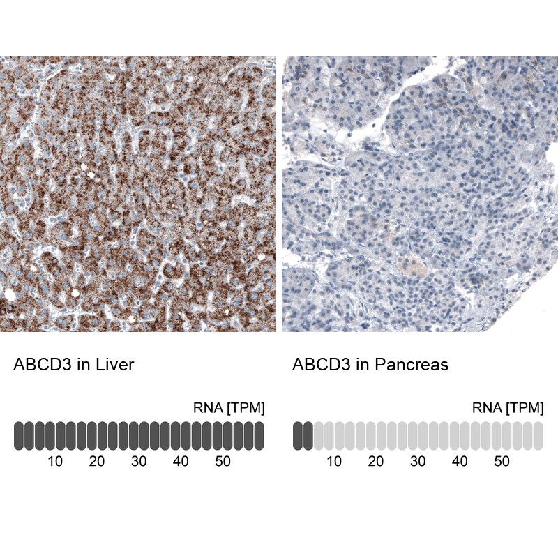 PMP70 Antibody (CL2524) Immunohistochemistry: PMP70 Antibody (CL2524) [NBP3-52459]