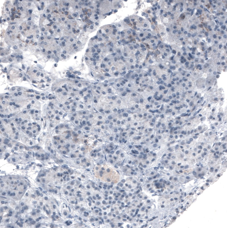 PMP70 Antibody (CL2524) Immunohistochemistry: PMP70 Antibody (CL2524) [NBP3-52077]