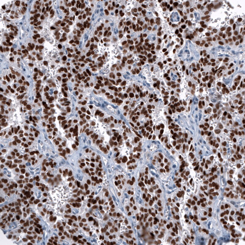 OTP Antibody (CL11225) Immunohistochemistry: OTP Antibody (CL11225) [NBP3-52439]