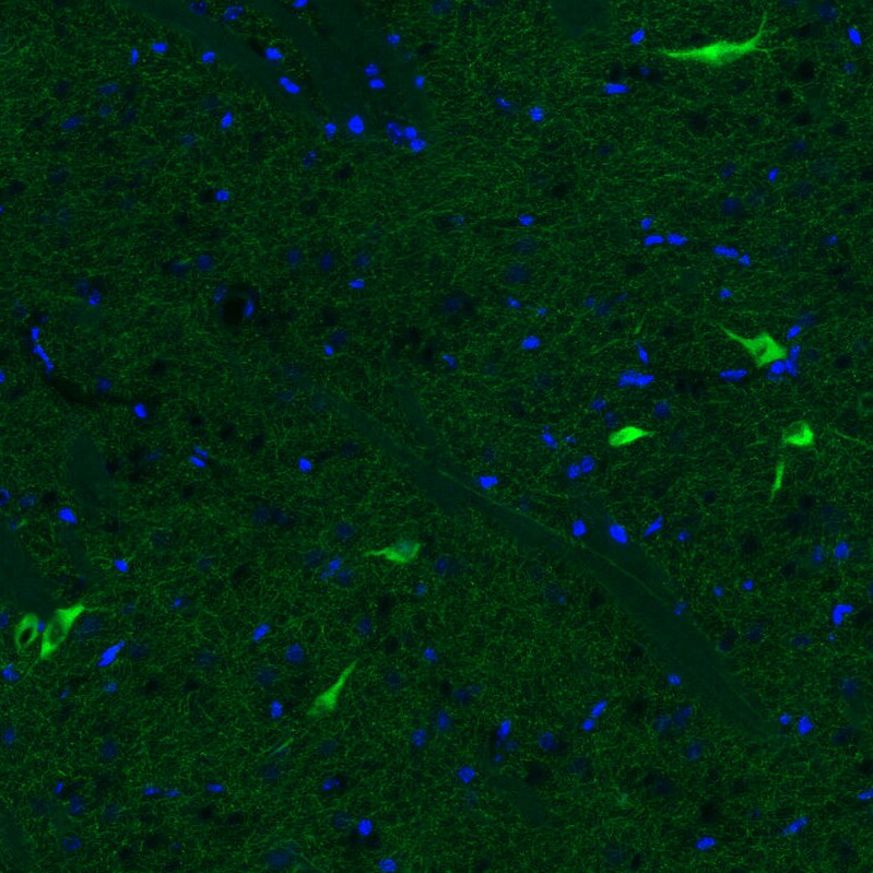 Choline Acetyltransferase/ChAT Antibody (CL3173) Immunohistochemistry: Choline Acetyltransferase/ChAT Antibody (CL3173) [NBP3-52467]