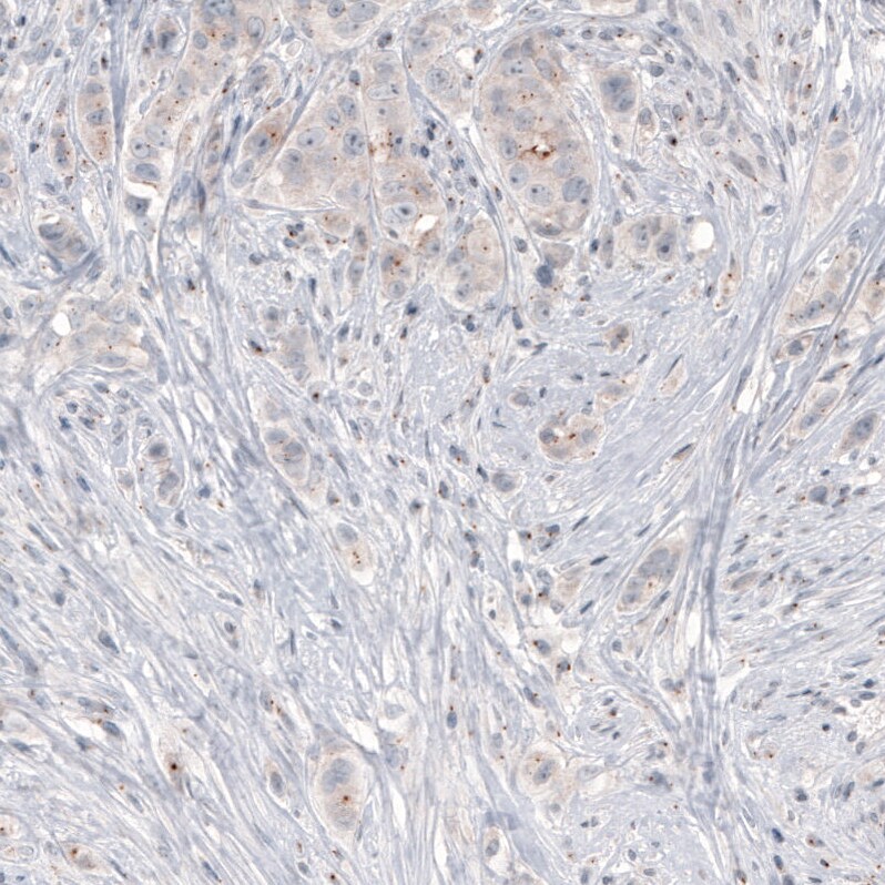 CEP350 Antibody (CL3423) Immunohistochemistry: CEP350 Antibody (CL3423) [NBP3-52470]