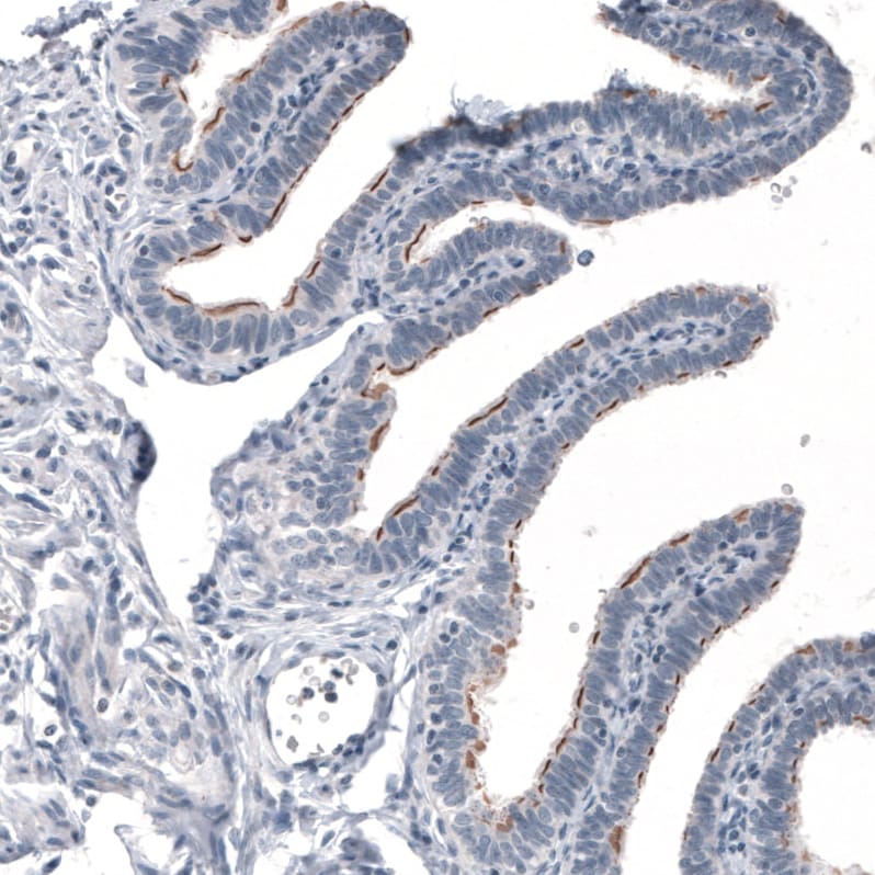 CEP350 Antibody (CL3423) Immunohistochemistry: CEP350 Antibody (CL3423) [NBP3-52470]