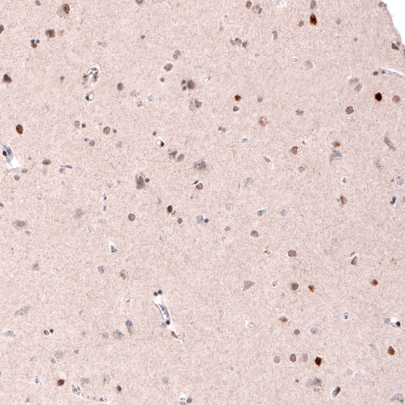 CDP/CUTL1 Antibody (CL5278) Immunohistochemistry: CDP/CUTL1 Antibody (CL5278) [NBP3-52477]