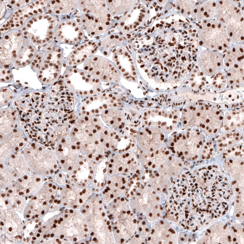 CDP/CUTL1 Antibody (CL5278) Immunohistochemistry: CDP/CUTL1 Antibody (CL5278) [NBP3-52477]