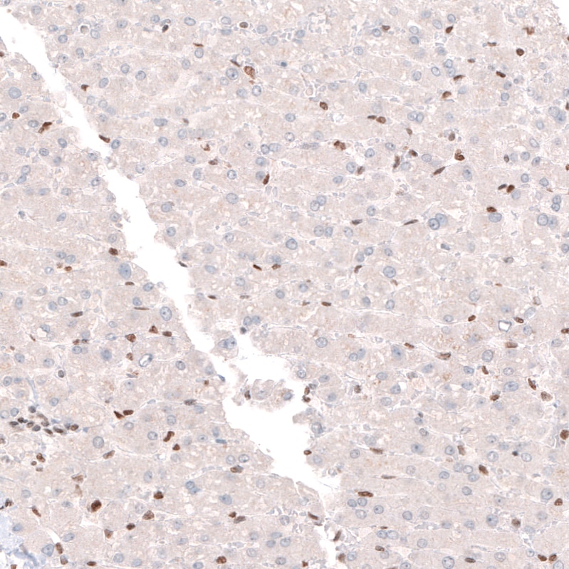 CDP/CUTL1 Antibody (CL5278) Immunohistochemistry: CDP/CUTL1 Antibody (CL5278) [NBP3-52477]