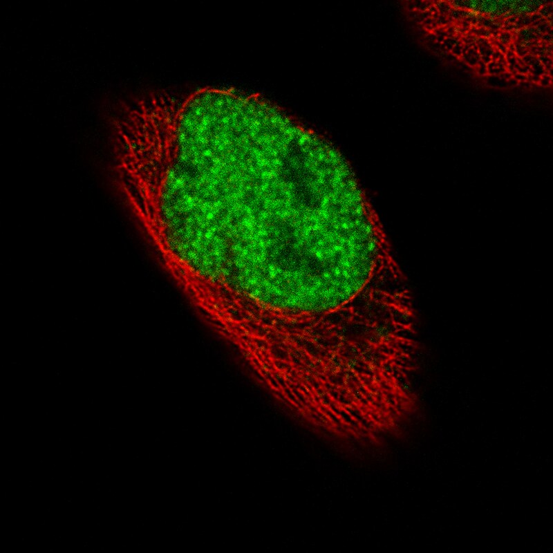 FoxP2 Antibody (CL5312) Immunocytochemistry/ Immunofluorescence: FoxP2 Antibody (CL5312) [NBP3-52480]