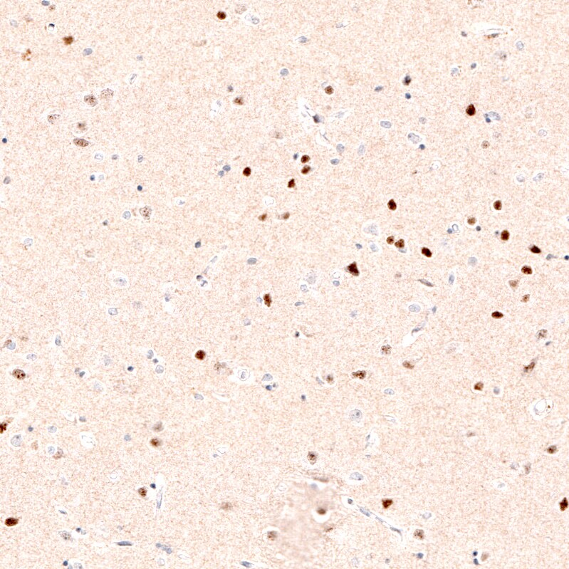 FoxP2 Antibody (CL5312) Immunohistochemistry: FoxP2 Antibody (CL5312) [NBP3-52480]
