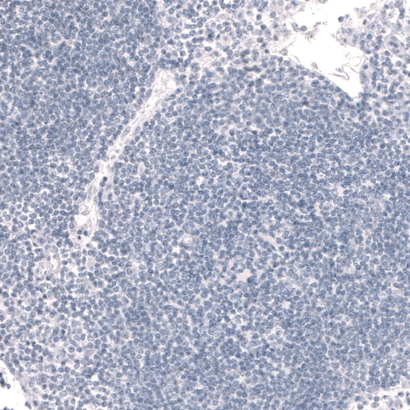 FoxP2 Antibody (CL5312) Immunohistochemistry: FoxP2 Antibody (CL5312) [NBP3-52480]