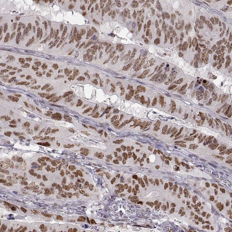 Snail Antibody (CL3700) Immunohistochemistry: Snail Antibody (CL3700) [NBP3-52471]
