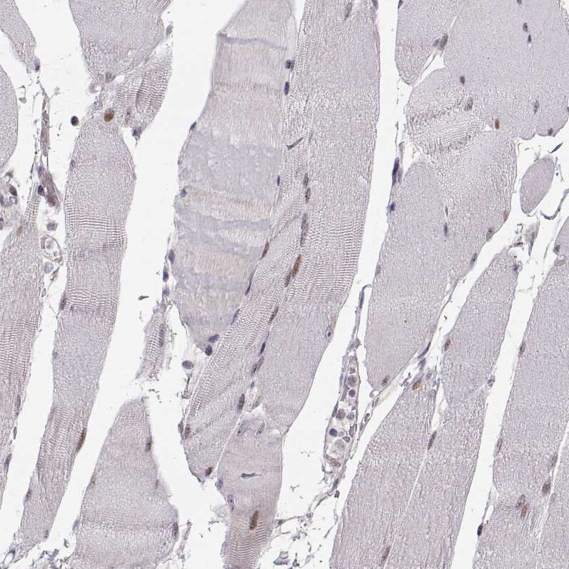 Snail Antibody (CL3700) Immunohistochemistry: Snail Antibody (CL3700) [NBP3-52471]