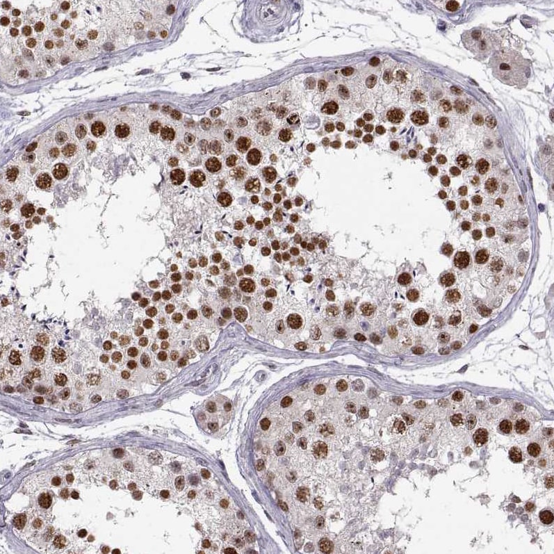 Snail Antibody (CL3700) Immunohistochemistry: Snail Antibody (CL3700) [NBP3-52083]