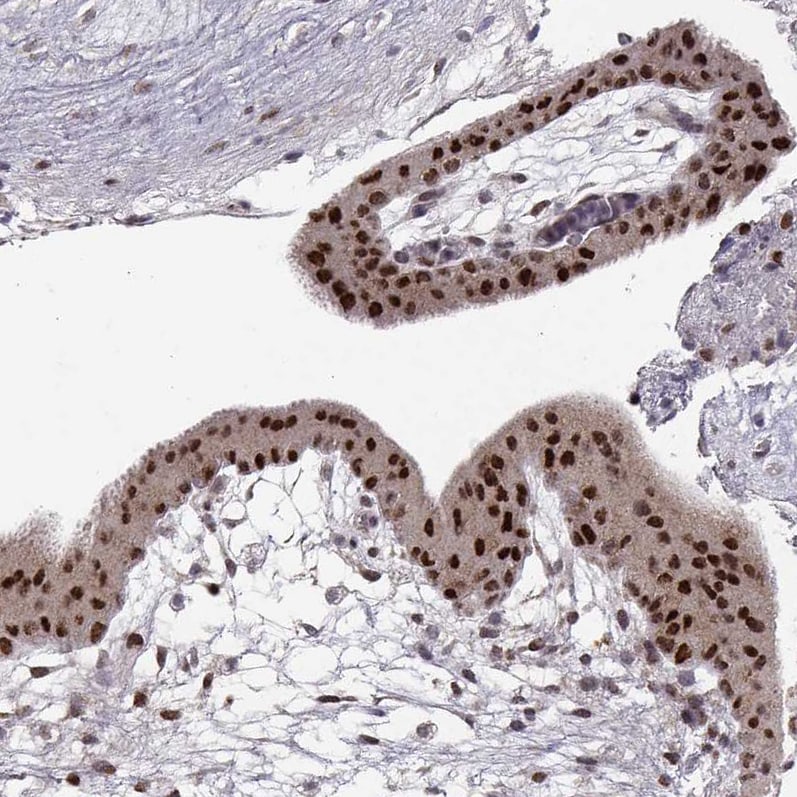 Snail Antibody (CL3700) Immunohistochemistry: Snail Antibody (CL3700) [NBP3-52083]