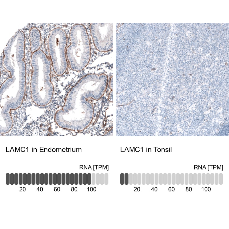 Laminin gamma 1 Antibody (CL3196) Immunohistochemistry: Laminin gamma 1 Antibody (CL3196) [NBP3-52468]